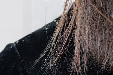 頭皮の乾燥には☆