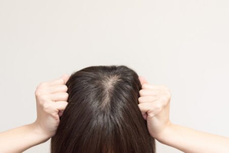 気になるパックリ分け目☆