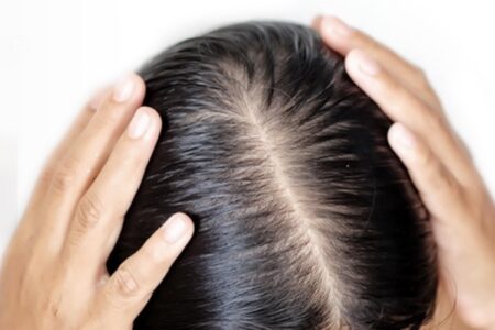 同じ分け目ってどうなの☆