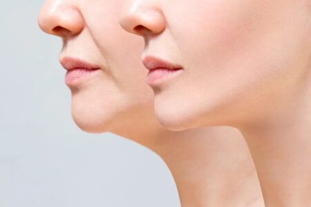 副作用のないインナーケア☆