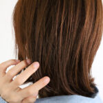 日本人のいや〜な赤み☆