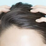 いま抜け毛が気になる人は☆