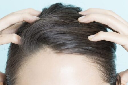 いま抜け毛が気になる人は☆